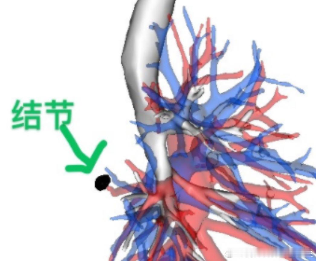 36岁男性患者，半年前查出右下肺背段有个6mm的磨玻璃结节，之后他就特...