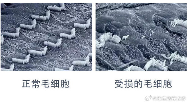 【10分钟；③ 全天累计佩戴时长，尽量不超过3小时，不戴耳机入睡；④ ...