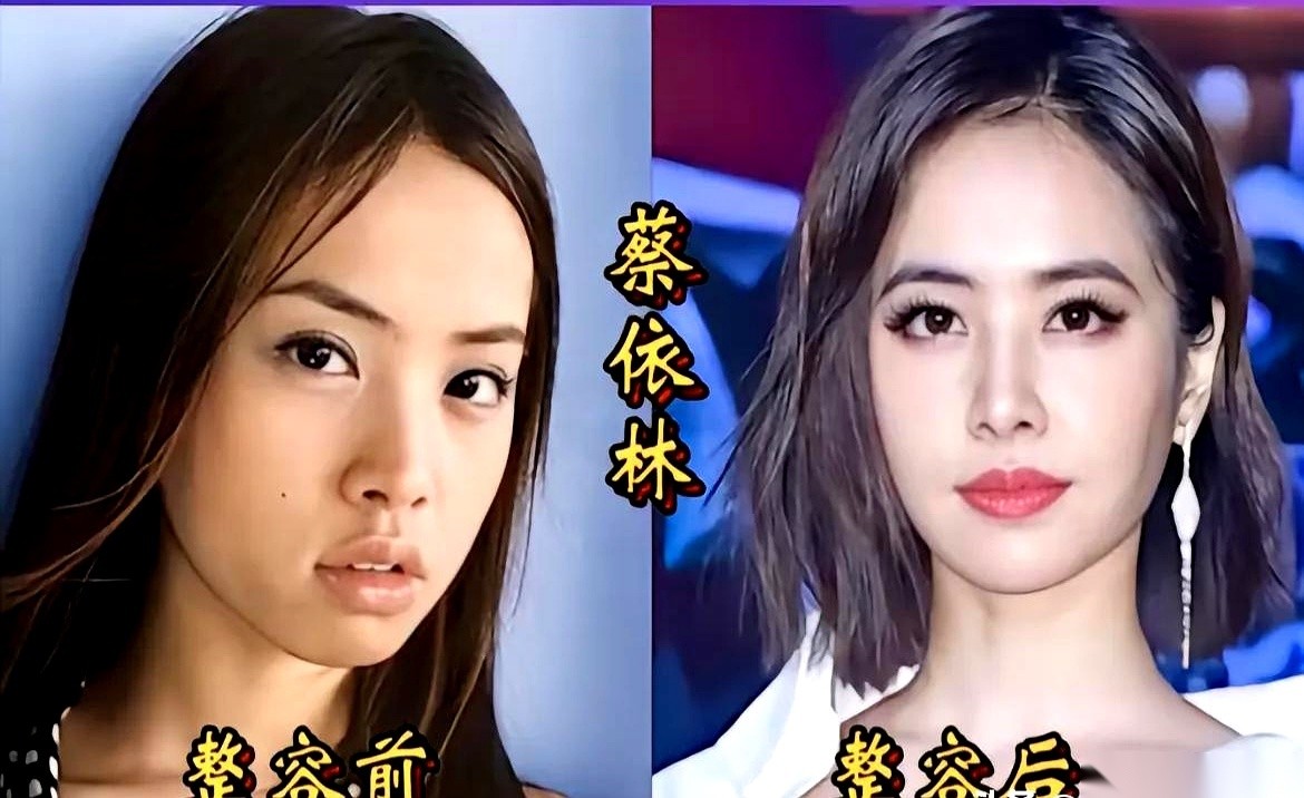 蔡依林刚出道时带着青涩感，如今蜕变成了自信耀眼的模样。
她和王鸥、鞠婧祎等女艺人肉眼可见的样貌改变，被完全归因于时光沉淀。
孙菲菲、张靓颖和娄艺潇等人的容貌差异，剩下的解释只有妆容造型和拍摄光影的加持。
咱们老百姓看这帮明星的早年照片，再对比现在的精修图，心里其实跟明镜似的。
名单里还躺着邵音音、杨
