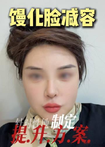 馒化会自己消失吗 馒化修复骗局 馒化脸是怎么形成的原因 去馒化项目 去...