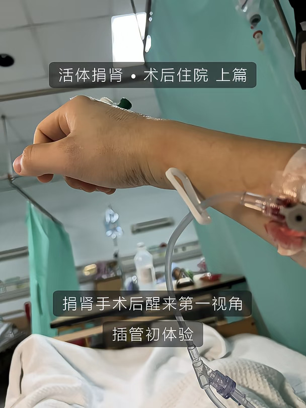 🏥活体捐肾Day480： 醒来身上插了3根管