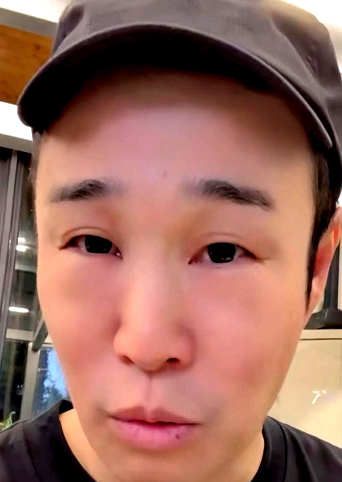 小沈阳顶着一张眼皮肿成核桃的脸，直接把没修过的素颜照发到了网上。

因为连轴转，他硬生生把身体熬垮了。那张脸看着明显透支，但他没发通稿卖惨，也没推掉工作。

在台下，他照样一遍遍死磕走位。

最后上了公演舞台，全开麦硬唱。