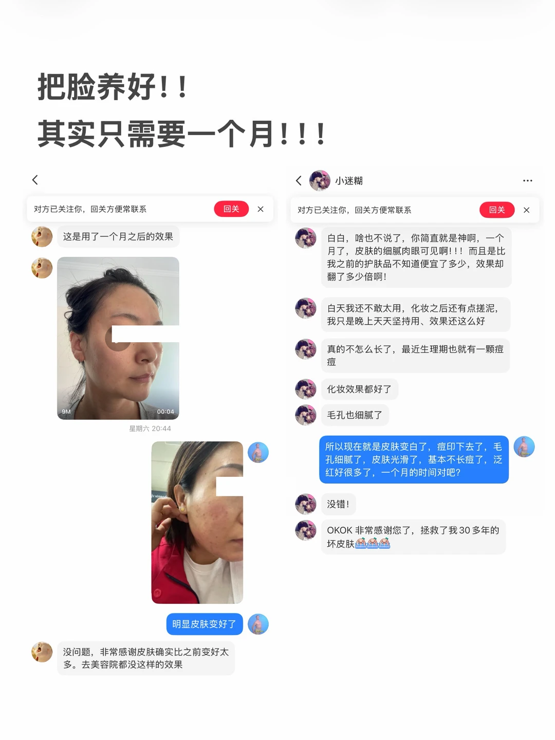 皮肤差的人如何一个月把脸养好（无广实话版）