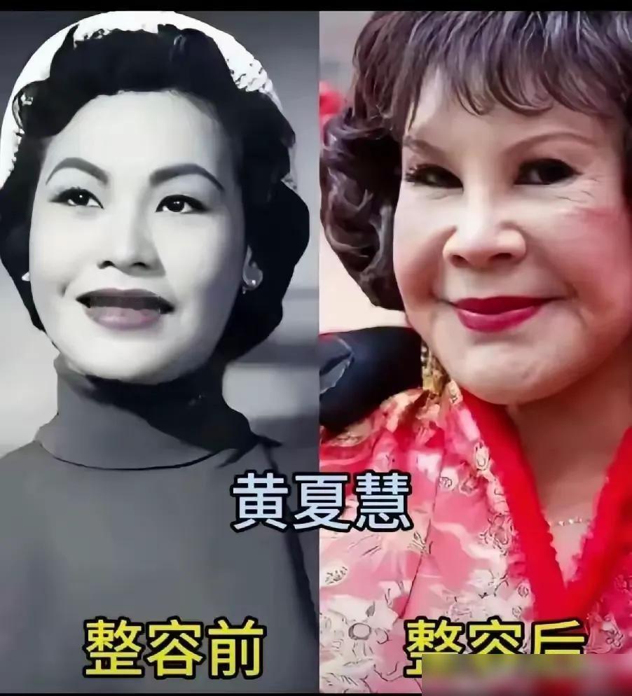 舒畅那张脸，上热搜了。38岁，品牌活动，生图一出来，评论区直接炸锅，说肿胀僵硬像戴了面具。她赶紧发素颜自拍，配文“我状态挺好的”。可越这么急着证明，越让人心里发毛。
赵露思也没逃过。运动品牌站台，侧面一拍，山根突起得吓人，鼻翼小到快喘不上气。Lisa在巴黎时装周，生图笑容都是僵的，梅根·福克斯更狠