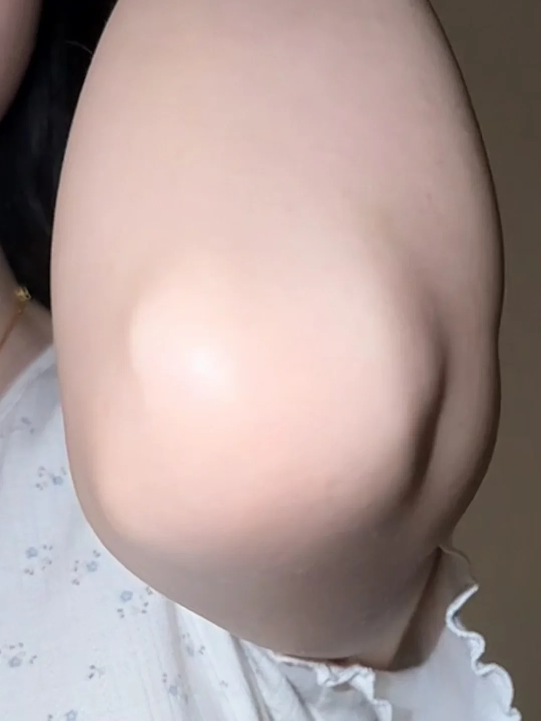 强推一个韩国的肘黑溶解剂