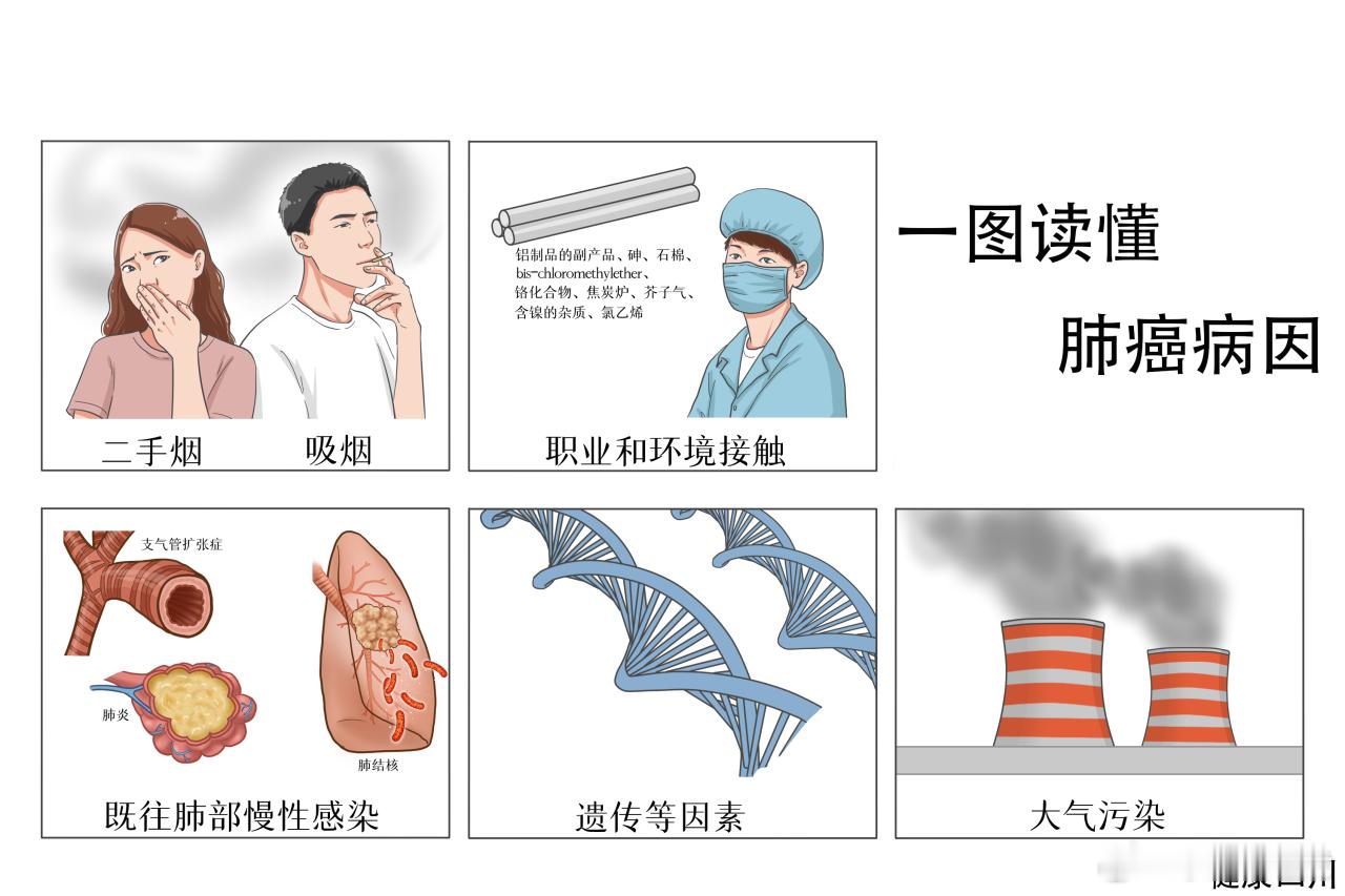 #女子回应不抽烟不熬夜确诊肺癌晚期#

很多人存在误区，认为肺癌主要发生于长期吸烟的男性。临床上女性肺癌发病率逐年上升，发病存在多重高危因素。

第一，厨房油烟暴露。烹调产生的油烟含有多环芳烃等致癌物，长期煎、炸、爆炒，通风条件差，是我国女性非吸烟肺癌重要的环境诱因。

第二，二手烟、三 ​