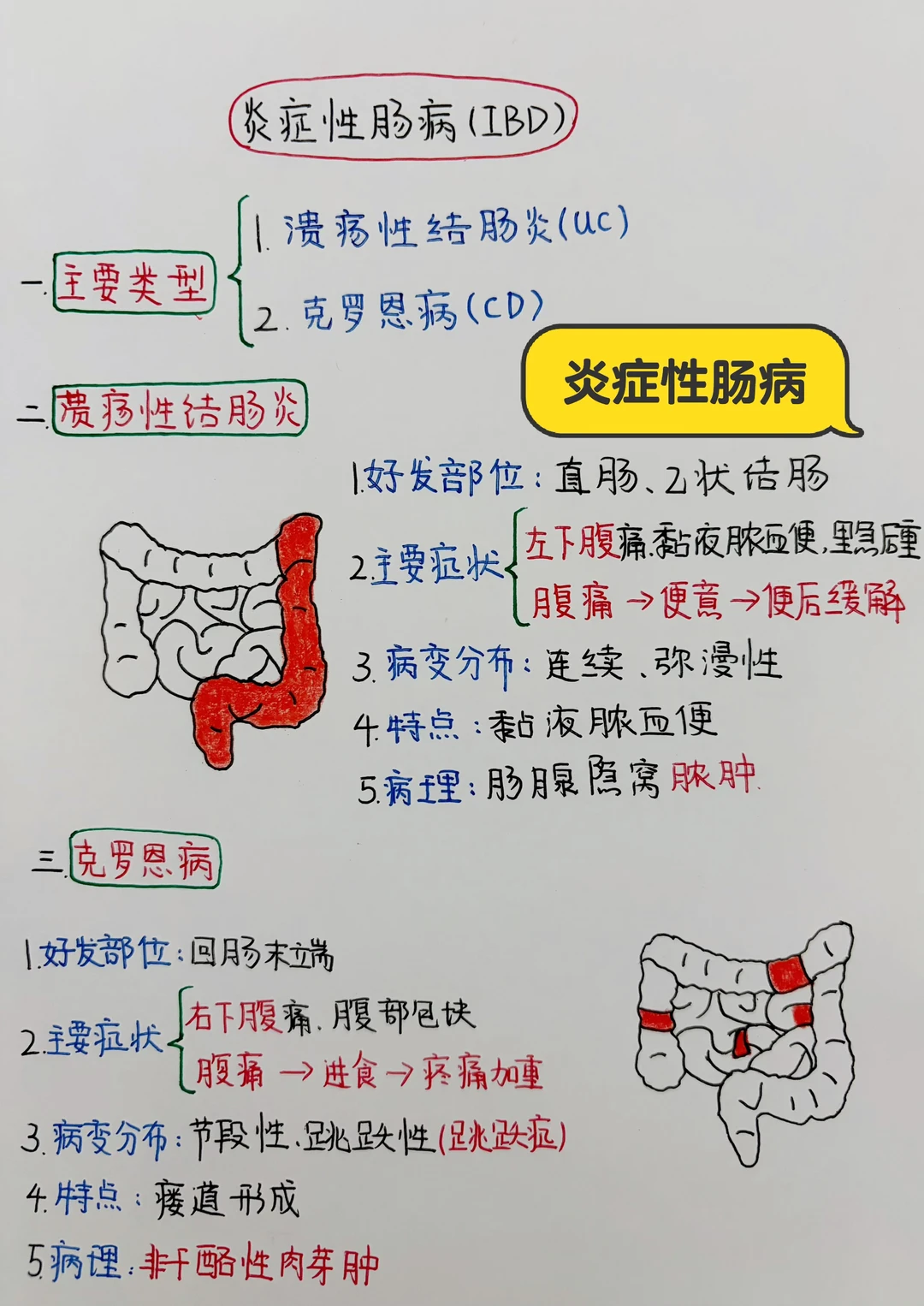 今日学习打卡——炎症性肠病IBD