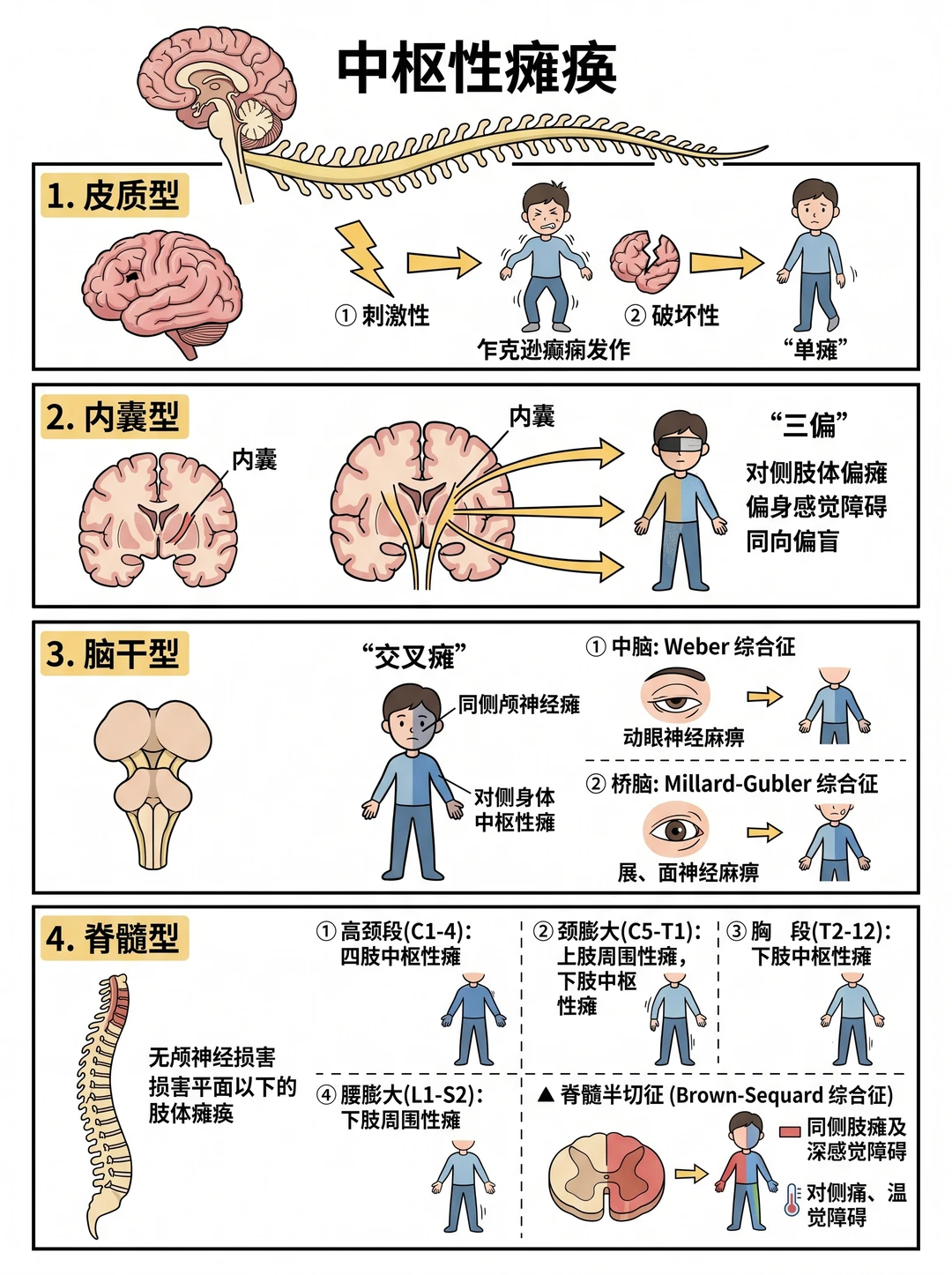 阿虎医考笔记📝｜中枢性瘫痪分类