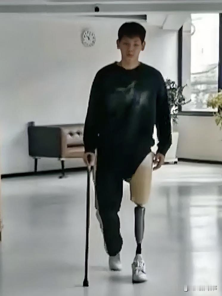 令人心疼！19岁速滑运动员遇意外截肢，冰上梦想破碎
 
竞技体育的残酷，远比我们看到的更沉重。
 
哈尔滨19岁速滑运动员王新睿，训练时和队友发生碰撞，冰刀割破腿部动脉，大出血重伤。
虽历经多次手术抢救，因肢体缺血坏死，最终无奈接受左腿截肢。
 
曾经拿下全国赛事奖项，怀揣冰场梦想的少年，亲口感慨：