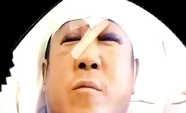 2001年曾志伟在酒吧被人拿烟灰缸猛砸，脸缝了整整29针，结拜大哥邓光荣刚撂下狠话“这事我管定了”，一打听到背后是英皇老板杨受成，立马劝他把这口恶气咽回肚子里
 

起因不过是曾志伟管不住嘴，公开嘲弄刚出道的容祖儿长相难看。平日里插科打诨习惯了，没成想直接踢在资本的铁板上
 

任凭早年在影坛多么呼