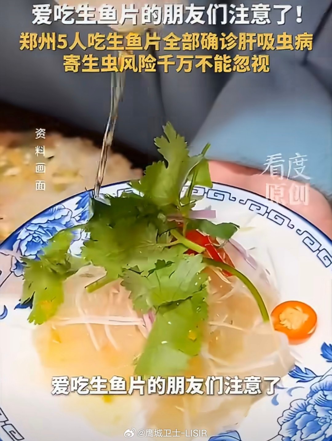 #5人聚餐后全部确诊肝吸虫病#
一场聚餐吃下淡水鱼生，五位食客全部确诊肝吸虫病，四人出现肝功能损伤，真实案例敲响饮食安全警钟。很多人误以为芥末、白酒可以杀灭寄生虫，实际上这类偏方完全无效，只有高温烹煮才能彻底清除囊蚴。餐饮门店即便分开刀具，消毒流程缺失依然埋下隐患。
美食追求口感无可 ​