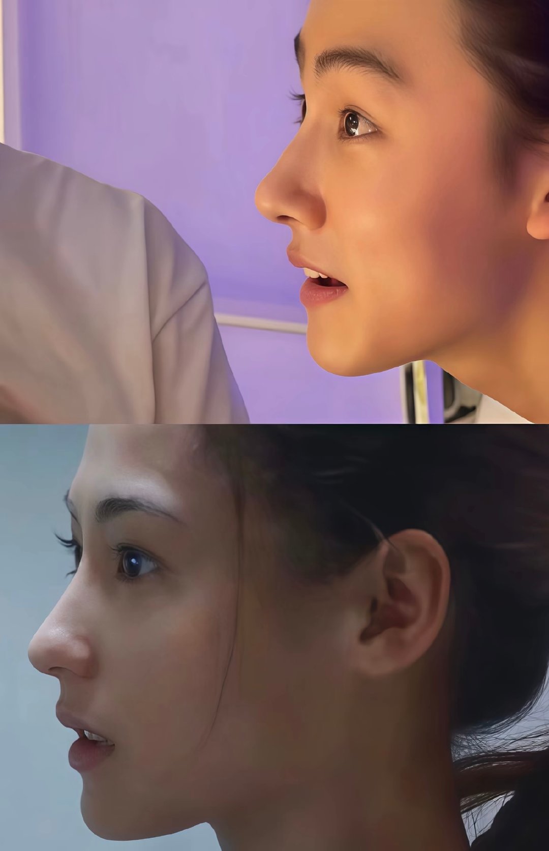 混血就是混血啊，张柏芝眉弓结构更明显、颧骨更靠后、脸颊纵深更立体，更过分的是鼻子反而没有很大很高，纯靠阶梯式的颌面结构形成立体度。 ​