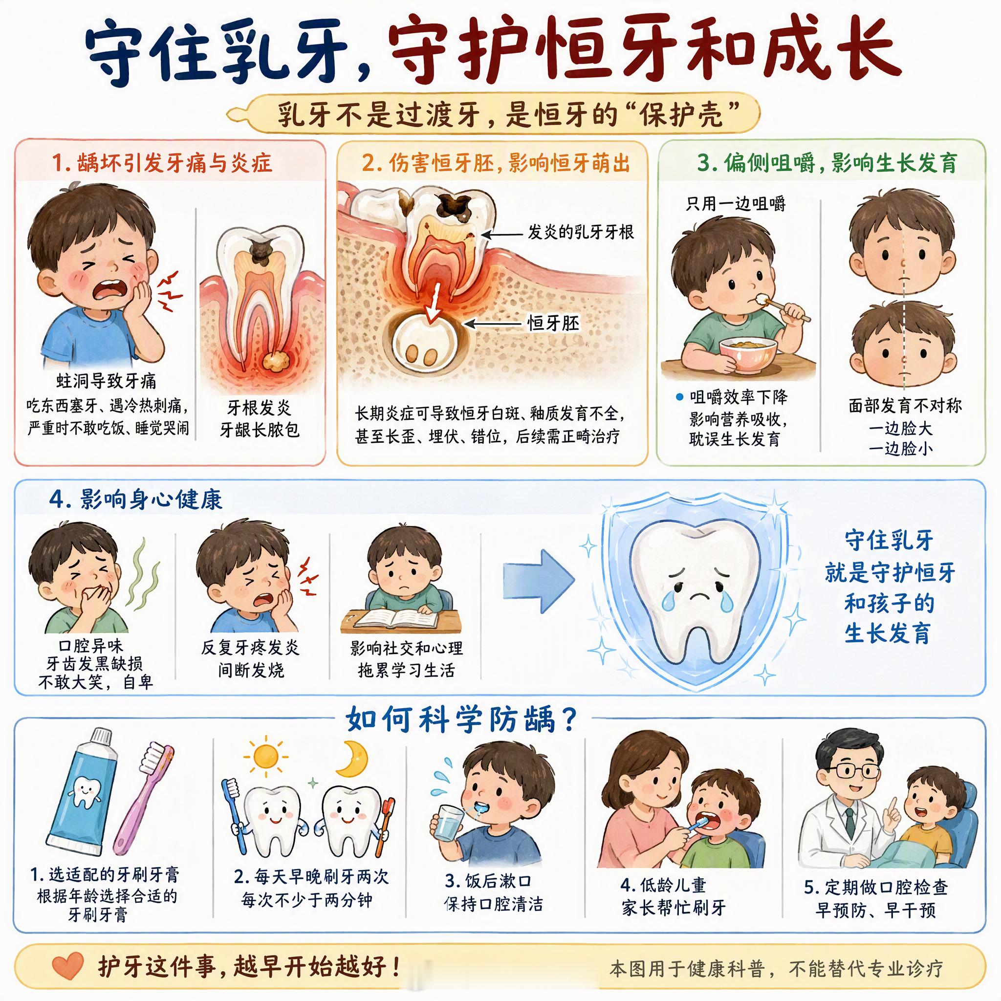 #白岩松谈儿童蛀牙危害#  #全国爱牙日#一旦乳牙发生龋坏，伤害是一连串连锁反应。

首先最直观就是牙疼。牙齿有蛀洞，吃东西塞牙、遇冷热就刺痛，严重的会引发牙根发炎、牙龈长脓包。很多孩子疼到不敢吃饭、睡觉哭闹。

更关键的，发炎的乳牙牙根，会直接伤害底下还没萌出的恒牙胚。恒牙在乳牙牙根下方 ​