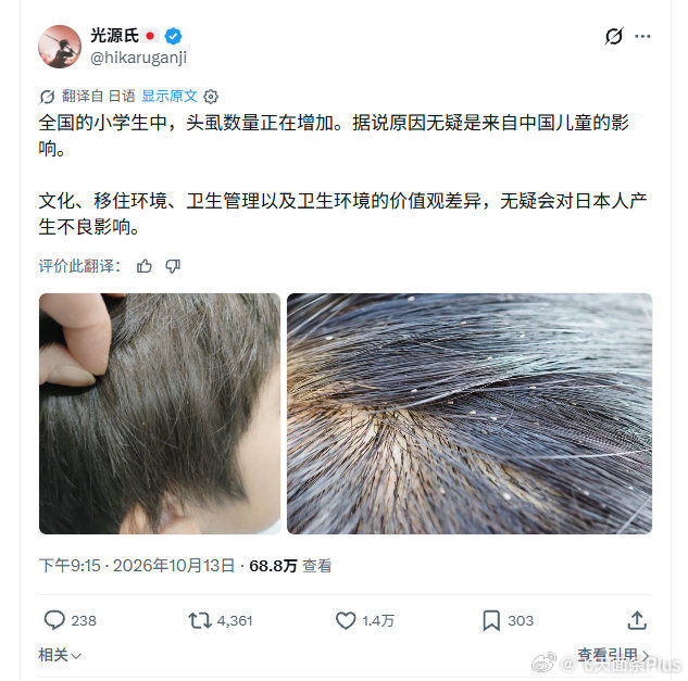是为了对冲这个热搜吗？
#医生在4岁宝宝睫毛上发现阴虱# ​