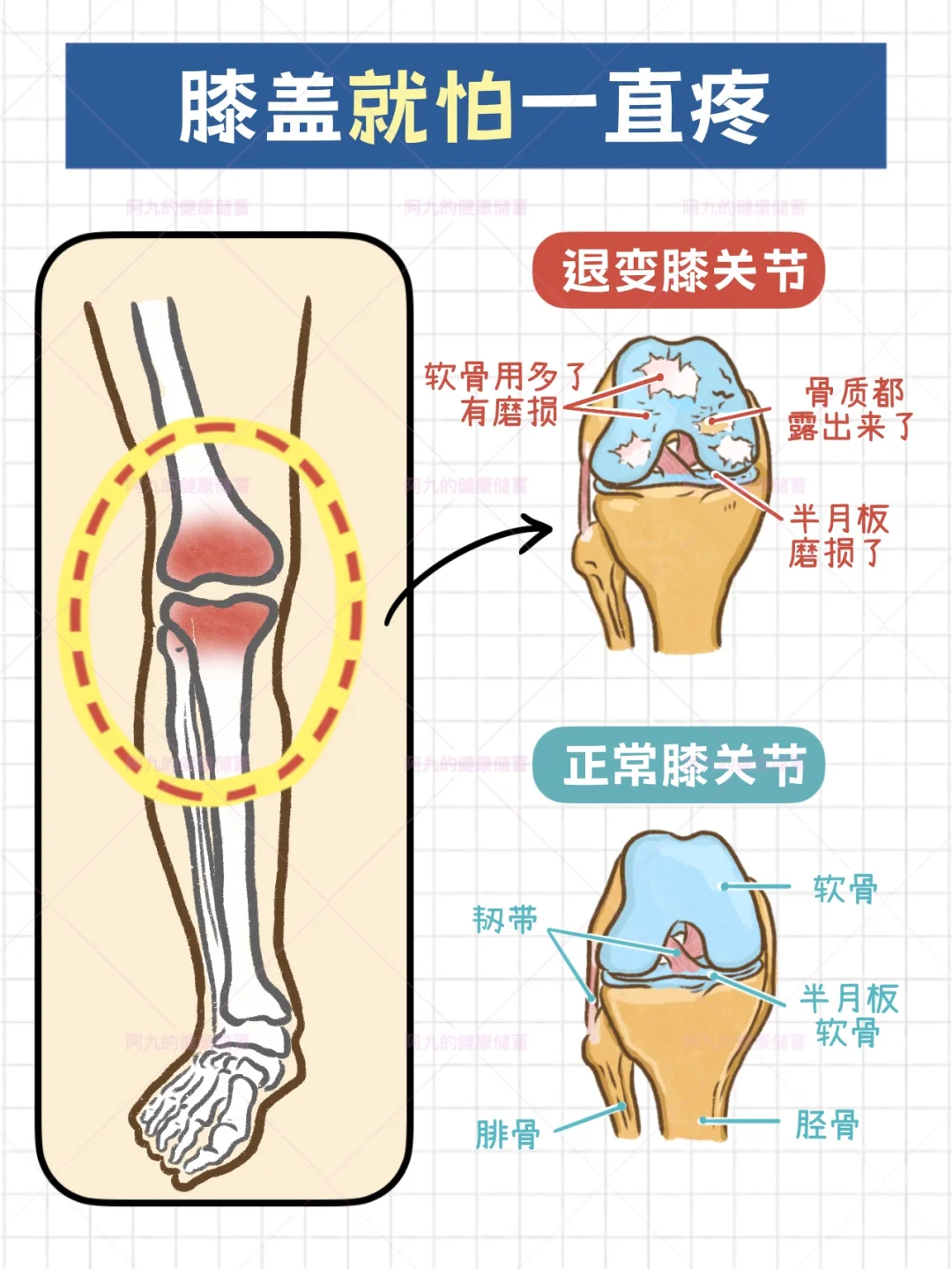 关节不舒服，吃氨糖到底有没有用？！