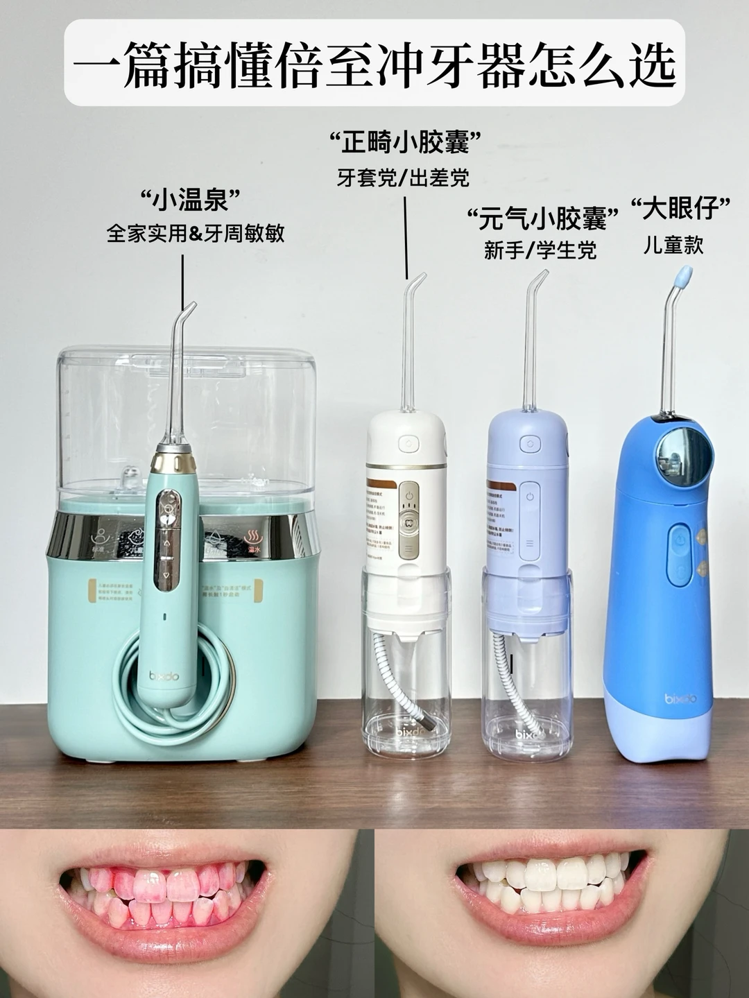 整牙800天亲测：倍至全系选购指南，终结选择