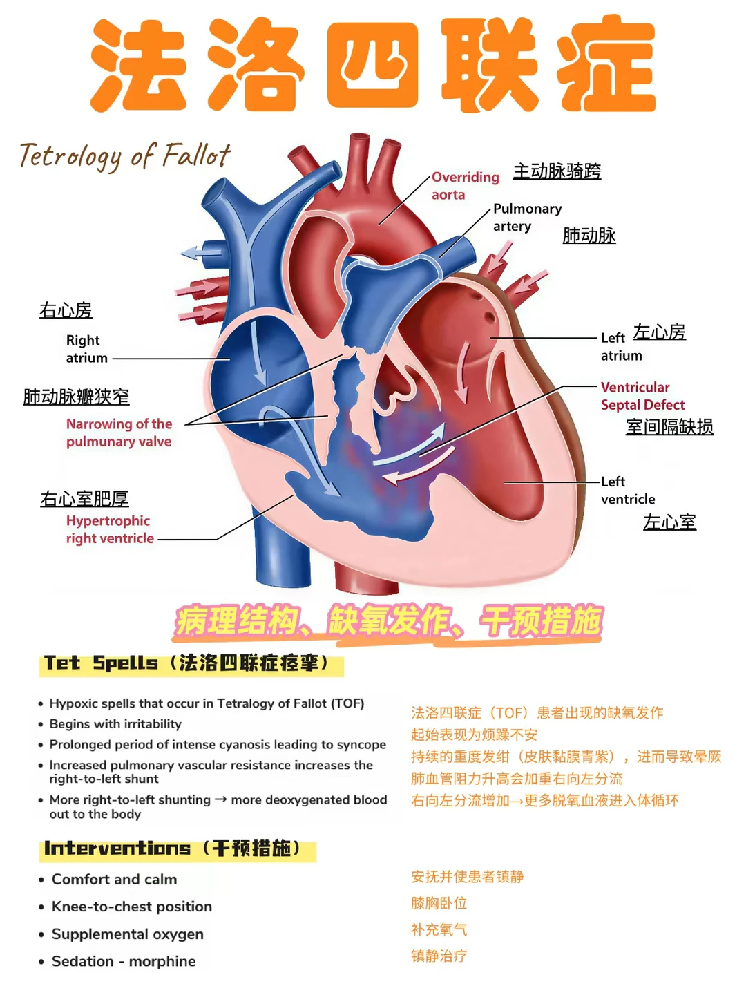 备考RN/法洛四联症！！学！！内容