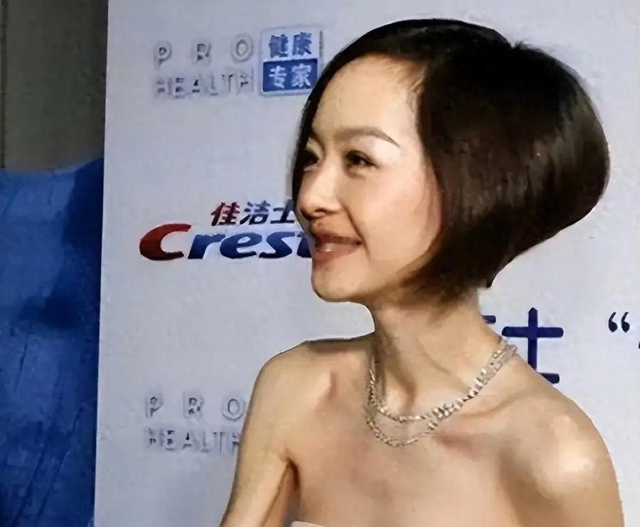 从130斤瘦到90斤切掉胆囊、300万烤瓷牙啃苹果要榨汁，内娱明星拿命换的脸面，普通人也在跟着买单
宋祖儿在片场因极端节食两次低血糖晕倒，导演紧急喊停拍摄。迪丽热巴为角色实行“晚餐封印”，半个月掉六斤，随后频繁感冒、眼神空洞。身高165cm的宋祖儿单薄到走路摇晃，177cm的罗云熙体重仅54公斤，B