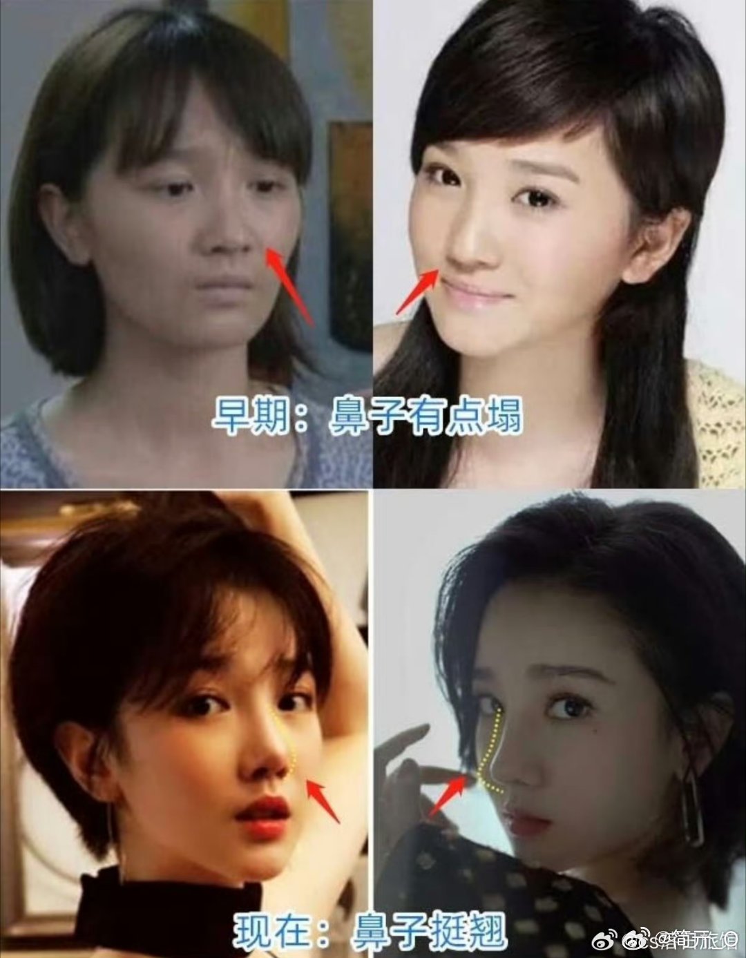 #陈小纭 整骨#可是我觉得早期更好看[爱慕] ​