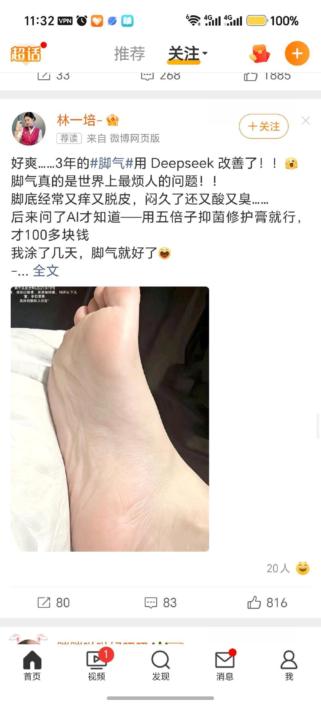 围脖广告要不要走心一点[泪奔][泪奔][泪奔]deepseek治jio气[泪奔][泪奔][泪奔]广告牛皮癣化了，迟早有一天见到deepseek治脱发，deepseek治不孕不育[泪奔][泪奔][泪奔] ​