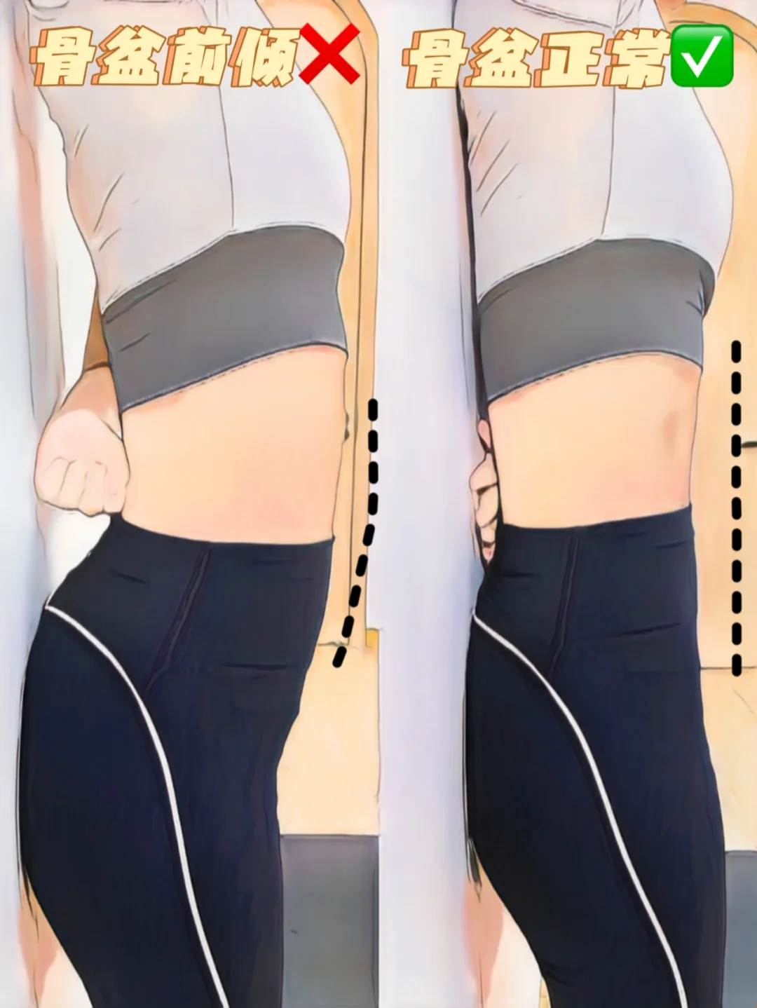 天呐!睡前四招搞定骨盆前倾，抚平小肚子！