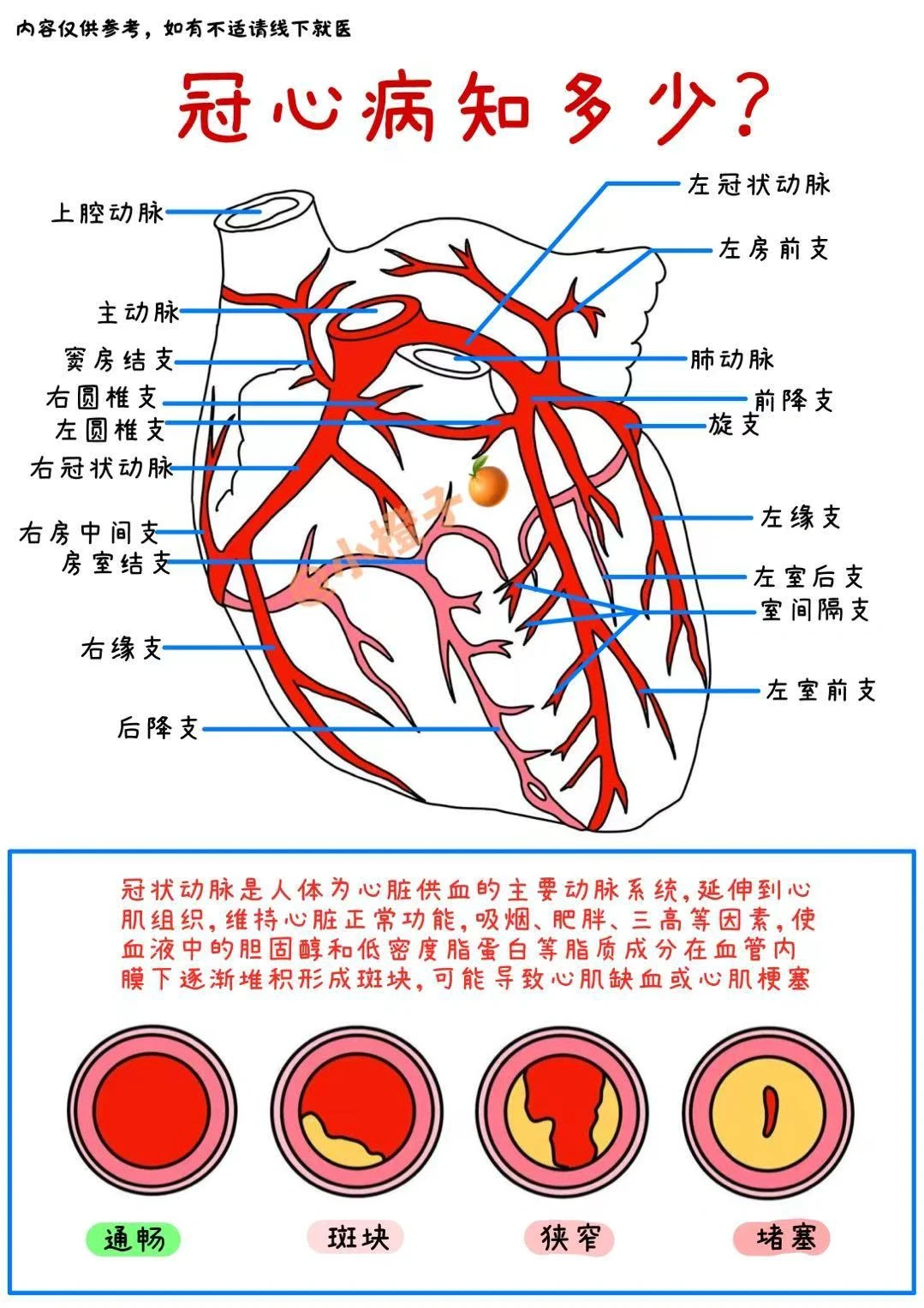 冠心病看这篇就够啦‼️附保险指南✅