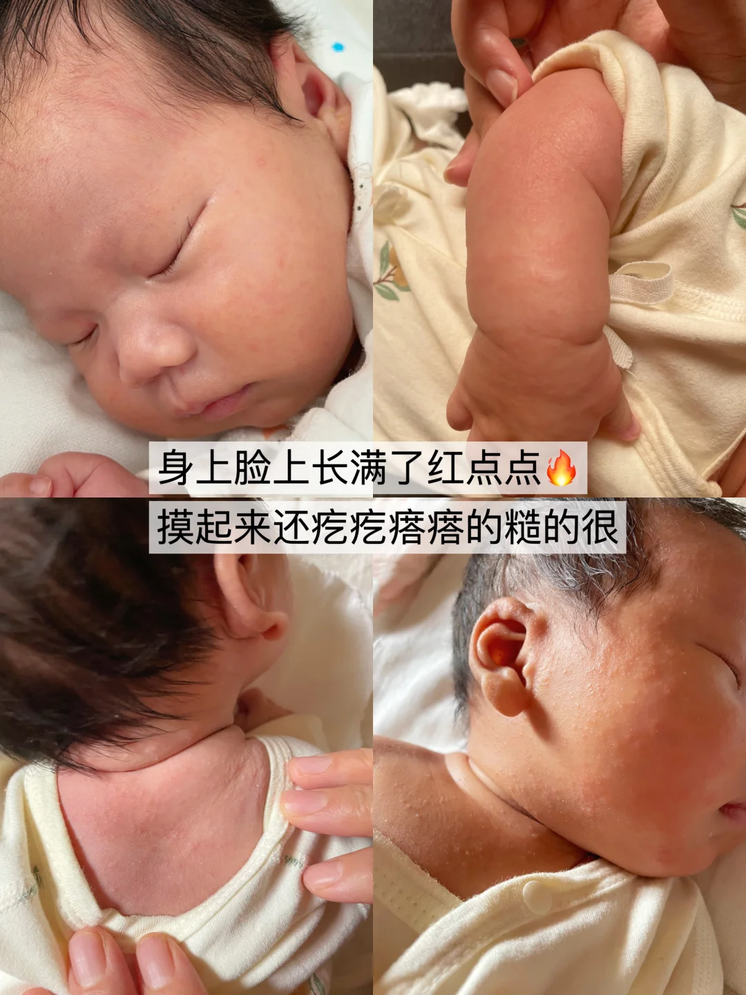 买了又买！秋冬红点点护理一瓶封神！