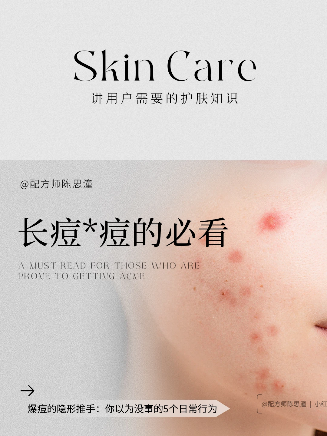 护肤知识｜这五个行为以为没事，其实...