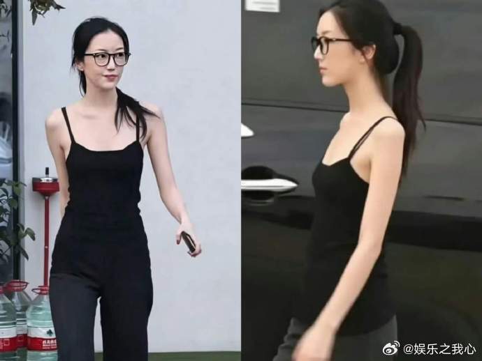 #李嫣几乎看不见唇腭裂修复痕迹#家人们，今天咱们来聊聊李嫣。不知道大家最近有没有注意到，曾经因唇腭裂备受关注的李嫣，如今竟几乎看不见唇腭裂修复的痕迹了！这一变化，真的就像一场无声却震撼的奇迹，在我们眼前悄然上演。
李嫣，作为公众人物王菲和李亚鹏的女儿，她的成长一直备受瞩目。她出生时 ​