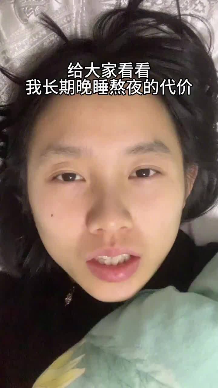 熬夜对人最直观的影响？脸色暗沉发黄，黑眼圈眼袋挂脸，山根那块发青，眼神都发直。说白了就是三字：暗、青、肿。白天脑袋昏昏沉沉，注意力根本集中不了，记性也变差。明明没干啥体力活，整个人像散了架似的，还容易烦躁，一点小事就心绪不稳。有网友说补觉能补回来，真不是那么回事。身体当天就降档运行了，长期熬夜的账，补觉根本还不清。最直观的，其实还是脸上那层灰气。虚了、衰了，好运都绕道走。你们一般熬到几点才睡？熬夜对人最直观的影响情感热点创作激励计划