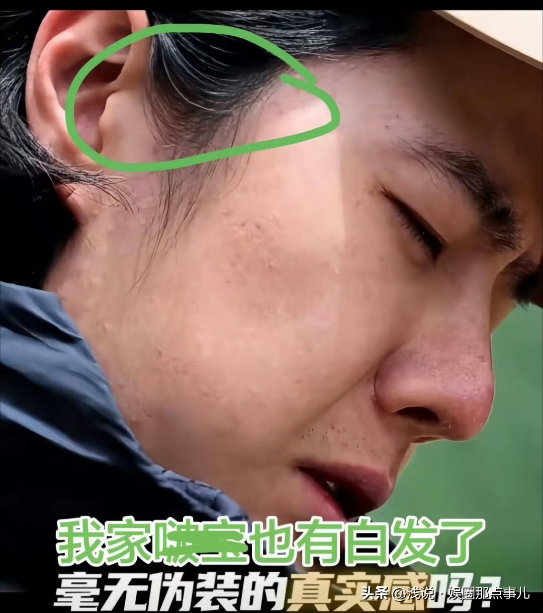 我的天哪，这还是顶流吗？王一博这也太糙了吧。
关键是他才29岁，白头发都愁出来了，他都是顶流了，他还有什么好愁的[捂脸]