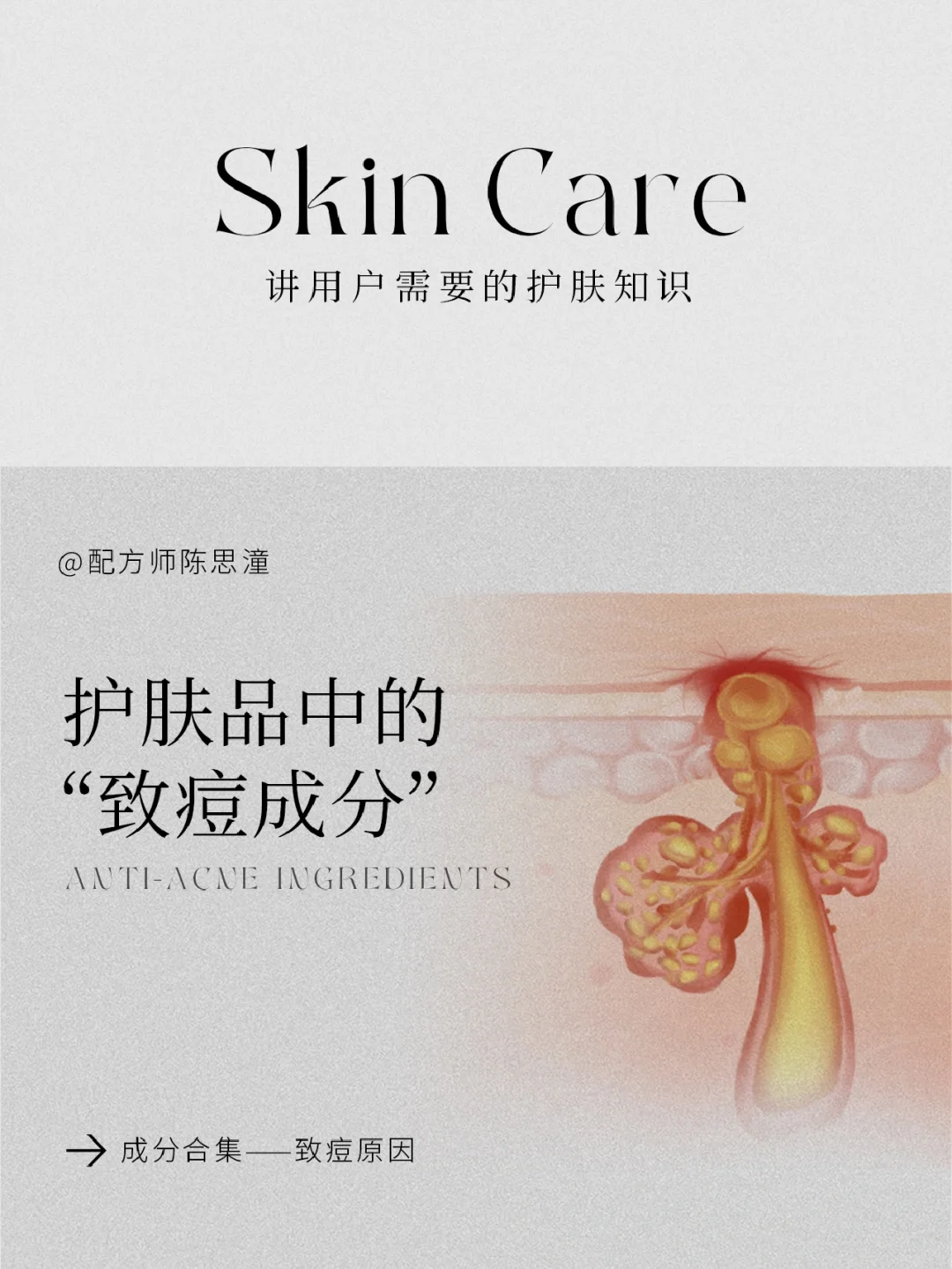 护肤知识｜护肤品中的“致痘成分”大合集