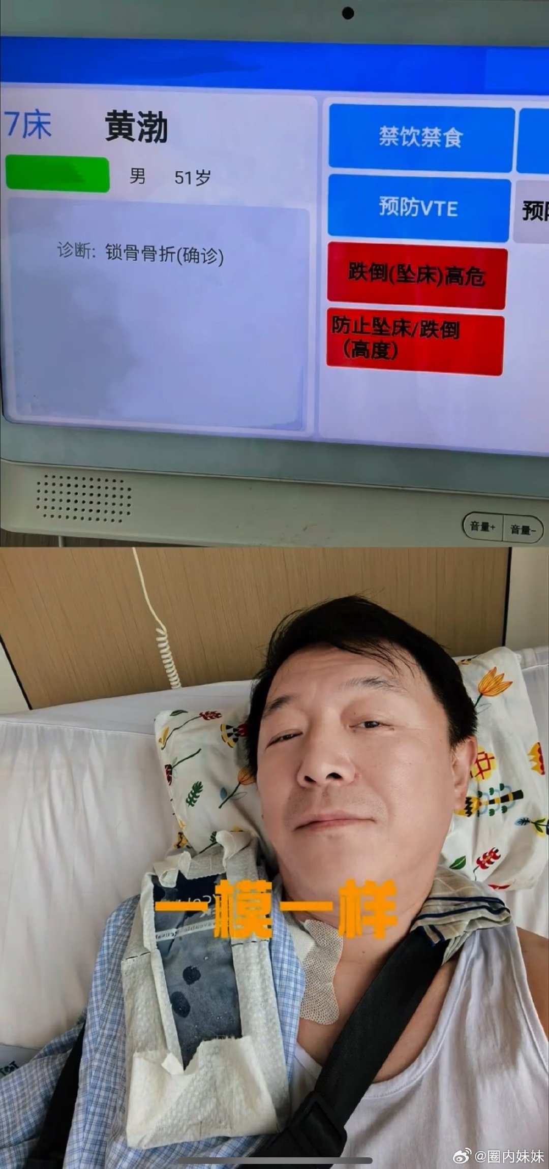 #黄渤锁骨骨折原因##黄渤说算是用自己的锁骨换了个提醒#黄渤发博回应骨折，哥这心态真的是绝了！疼痛是一时的，但幽默是刻在骨子里的。 ​
