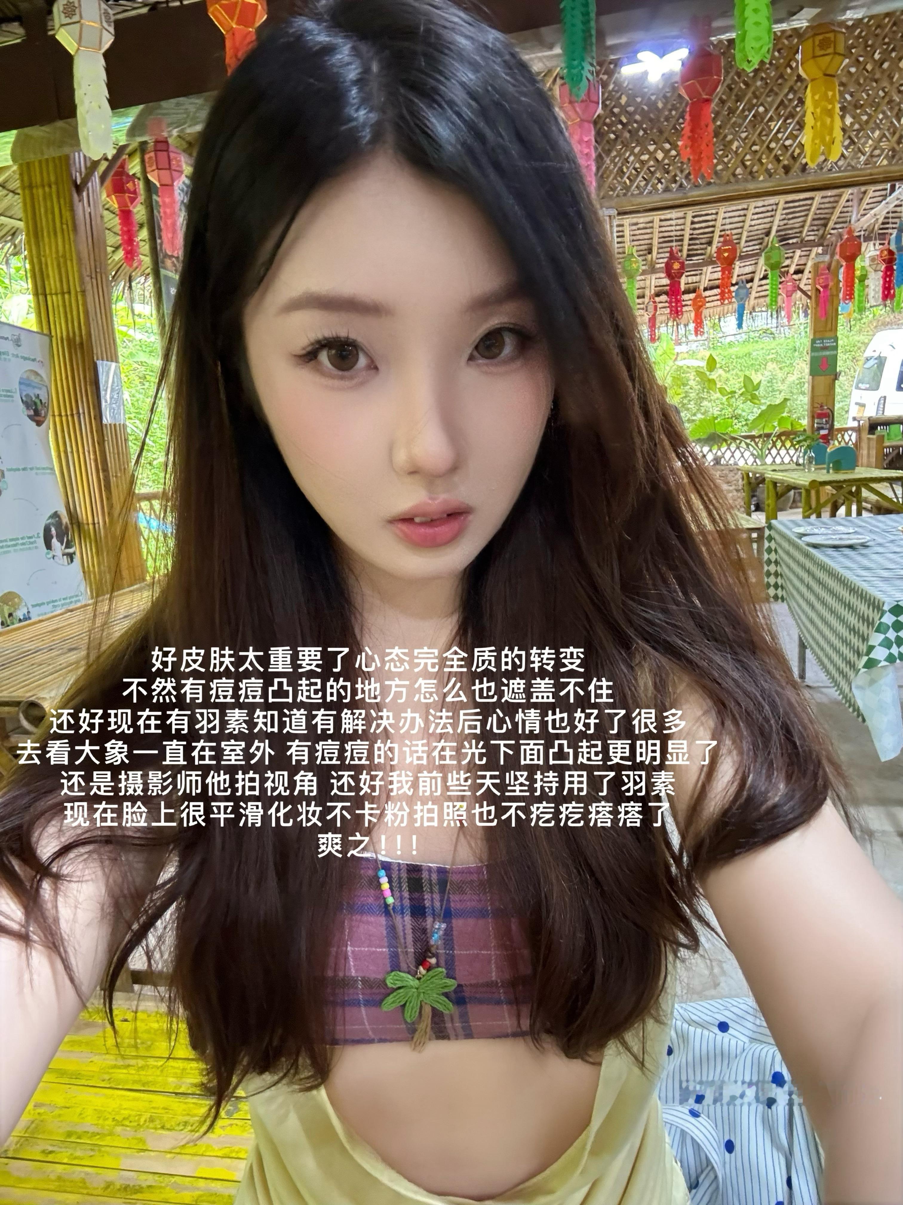 又来写我的心头爱💛不知道大家是不是和我一样来月经前就会来一波爆痘。这次有一颗长在鼻子下面又疼又痒的，眼看马上就要去度假，最怕脸上疙疙瘩瘩…游玩拍照心情都受影响，还好有我的老朋友羽素第三代祛痘大灯泡，直接成了我出行的底气！！这次冒出好几颗红肿痘，摸起来硬硬的，按压会有刺痛，洗脸的时候都得小心翼翼避开。赶紧拿出大灯泡来救急，我一般都是晚间护肤厚涂在痘痘位置，它的质地温润不粘腻，待它自行成膜，就不会沾到枕套。涂完能明显感觉到痘痘那种发胀灼热感在缓解，泛红也慢慢压下去。睡一觉起来，原本凸起的痘包瘪下去不少，疼痛感减轻，脓点也会慢慢收敛，不用上手挤，从根源避免泛红留印。平时额头下巴时不时冒出来的闭口小粉刺，我就白天薄涂。相当于自带一层防护，隔绝外界脏东西，还能调节肌肤出油，坚持用，闭口会慢慢代谢掉，减少反复长痘的困扰。它是无酸配方，我本身脸颊皮肤偏敏感，偶尔会有泛红破损，点涂上去也不会有刺痒不适感。一边帮助消痘，一边修护肌肤屏障，痘痘消退之后，红痘印淡化速度很不错，不容易留下久久不消的印记...