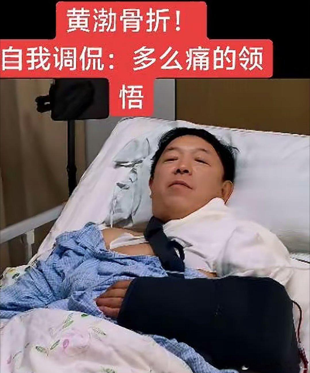 #黄渤骨折#黄渤自曝在家门口骑车“三心二意”导致锁骨骨折，目前正卧床静养。虽遭老罪，他仍苦中作乐唱起《多么痛的领悟》，自嘲“自行车一拐弯就拐进医院”。这份乐观豁达令人敬佩，也提醒大家：骑行务必专心，哪怕是在熟悉的家门口，安全第一！祝早日康复。 ​
