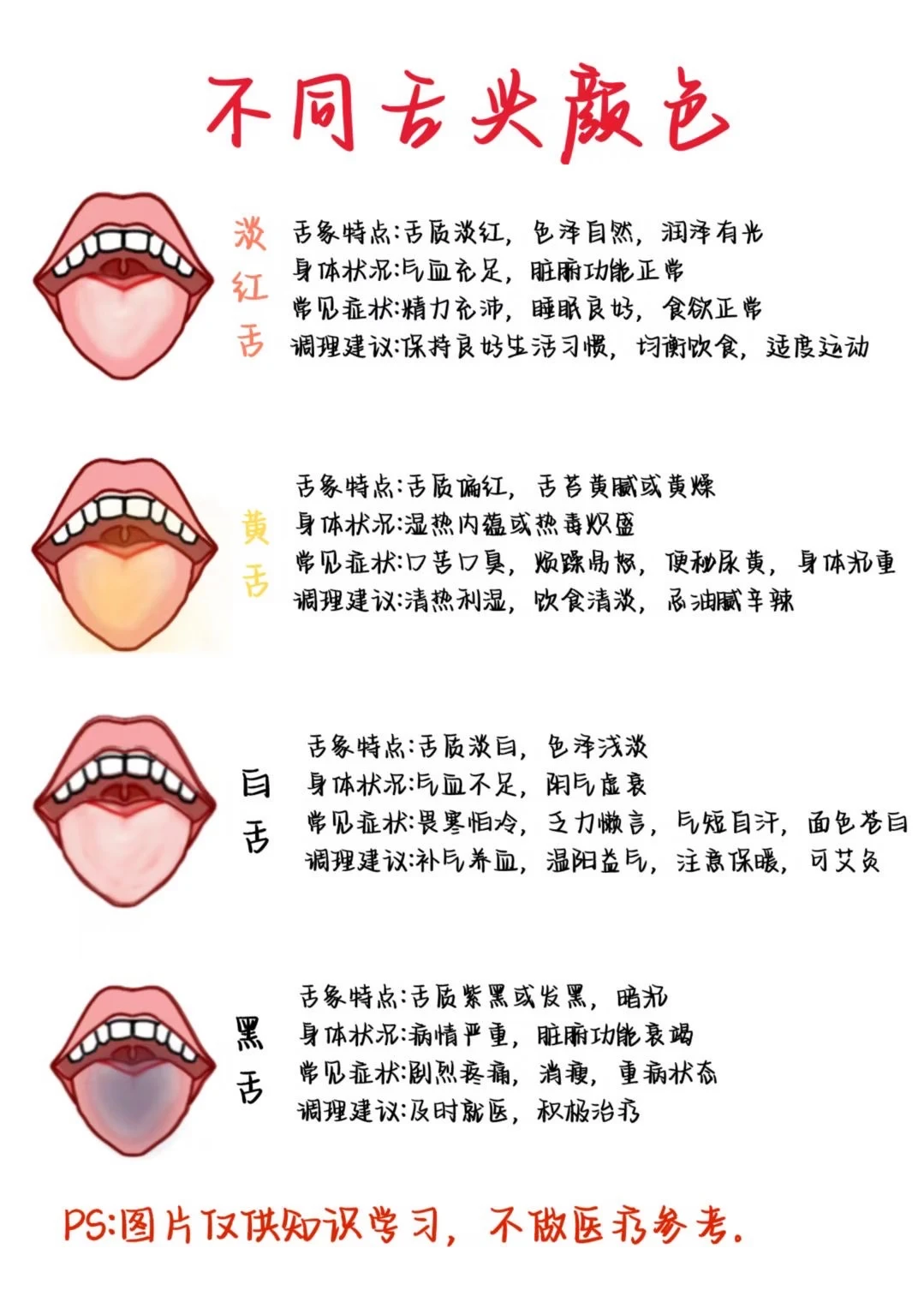 医学生笔记——不同舌头颜色