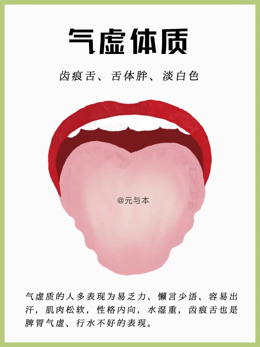 气虚体质：齿痕舌、容易乏力，喝四君子汤