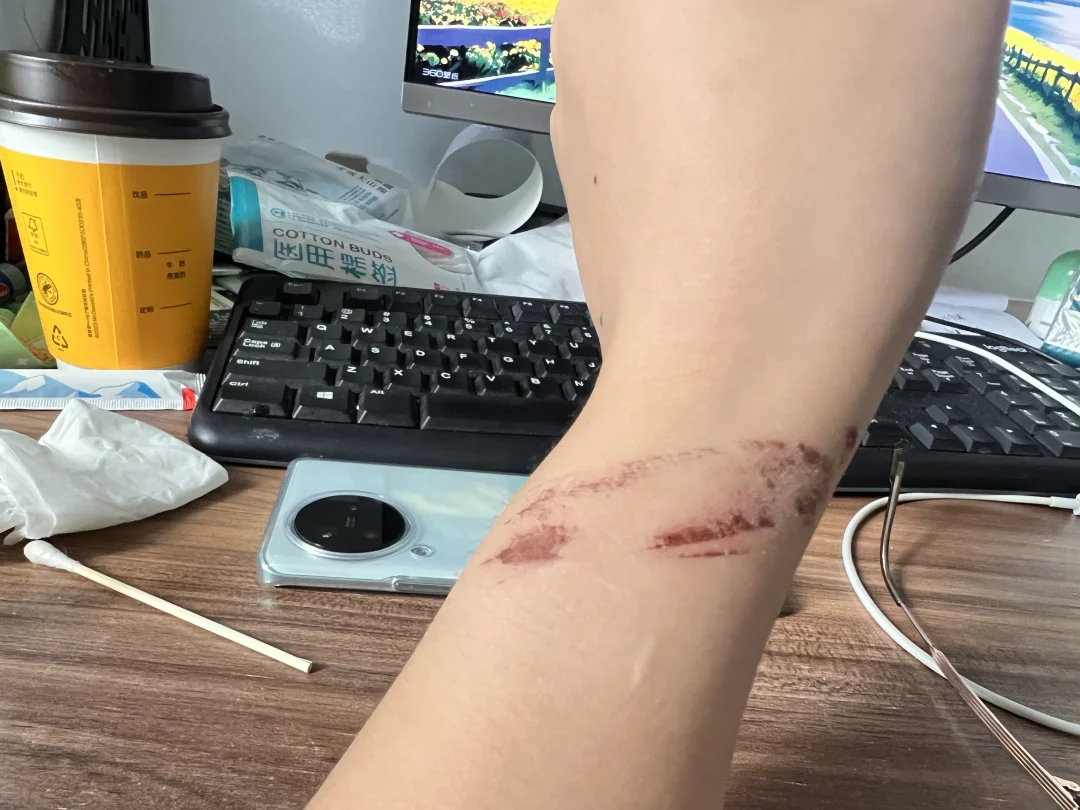 福来希你欠我的拿什么还😡