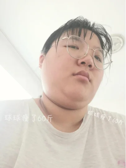 多囊，戒糖+养雌1年素颜已达next level