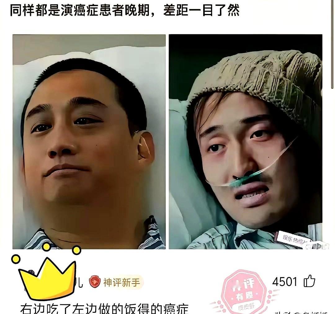 黄磊演个癌症晚期，弹幕里全在刷快让他吃口没熟的豆角。

口碑反噬的龙卷风，直接刮碎了他的演技滤镜。最近他演重病患者的片段被扒出，网友直接拿王传君来贴脸开大。一个眼窝深陷透着绝望，另一个气血充盈，把绝症演成了感冒。

其实大家嘲的早就不是演技。从厨房里那一锅锅翻车的炖肉开始，观众的心态就变了。现在不管