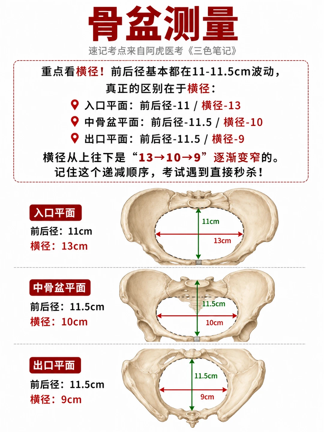 阿虎医考笔记 📒骨盆测量❤️