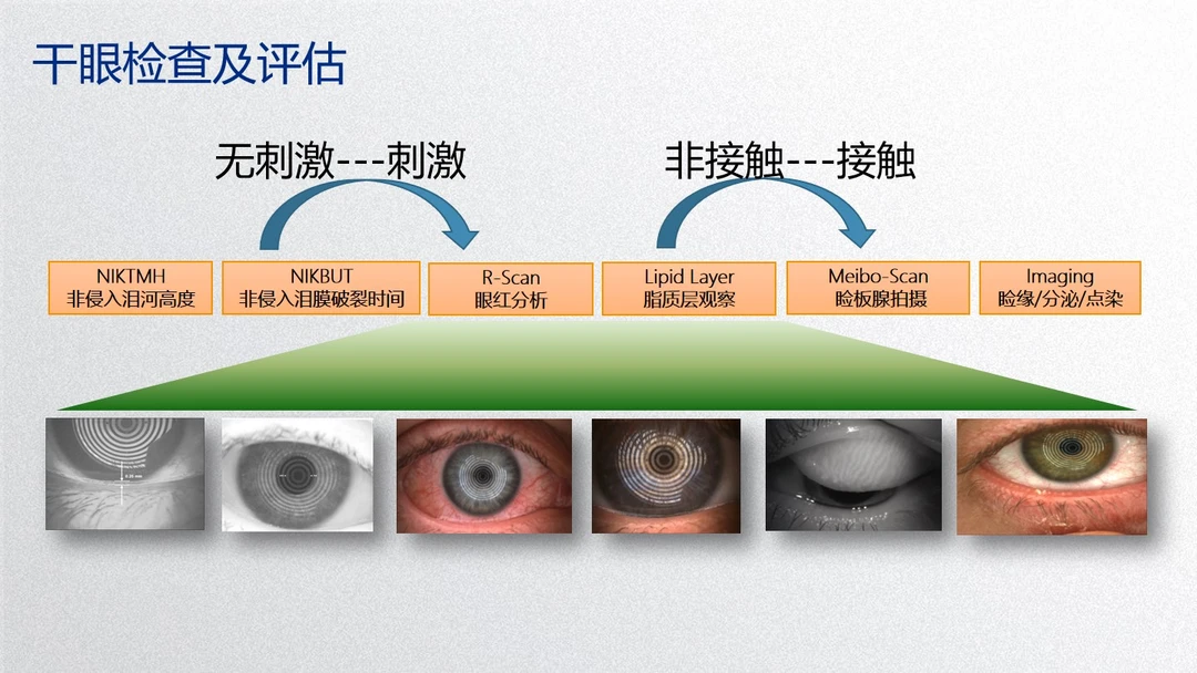 干眼检查项目与评估