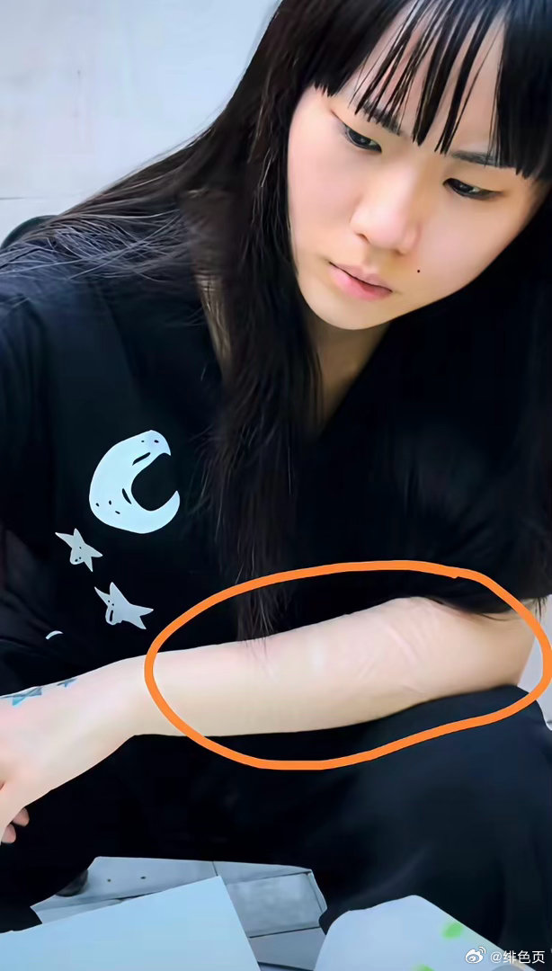窦唯这个二女儿到底经历了啥？整个手臂上这么多刀疤！
​接受采访的时候，她倒是曾经说过，有很长一段时间，自己走不出来，因为从小就经历非议，同时被拿来和窦靖童做比较。
​那也不能对自己下手啊~ ​