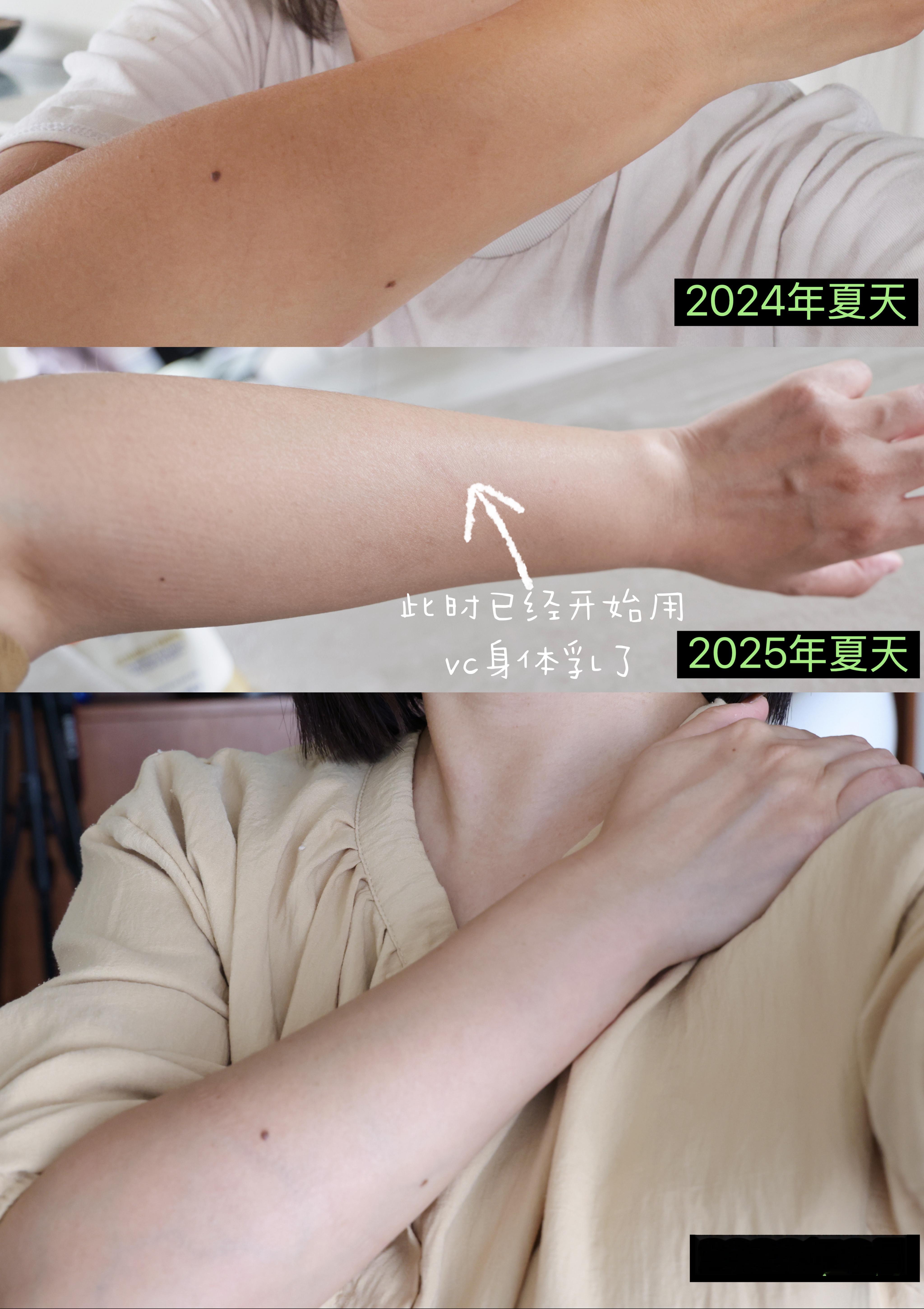 谁懂啊！我们这种天天防晒不离身的人，只要户外泳池一沾水5分钟就5分钟就全完！哈哈哈哈哈哈哈哈，然后又回到漫长的恢复阶段……谁懂啊！！！黑黄皮的苦啊哈哈哈哈哈哈哈哈哈。 ​​​