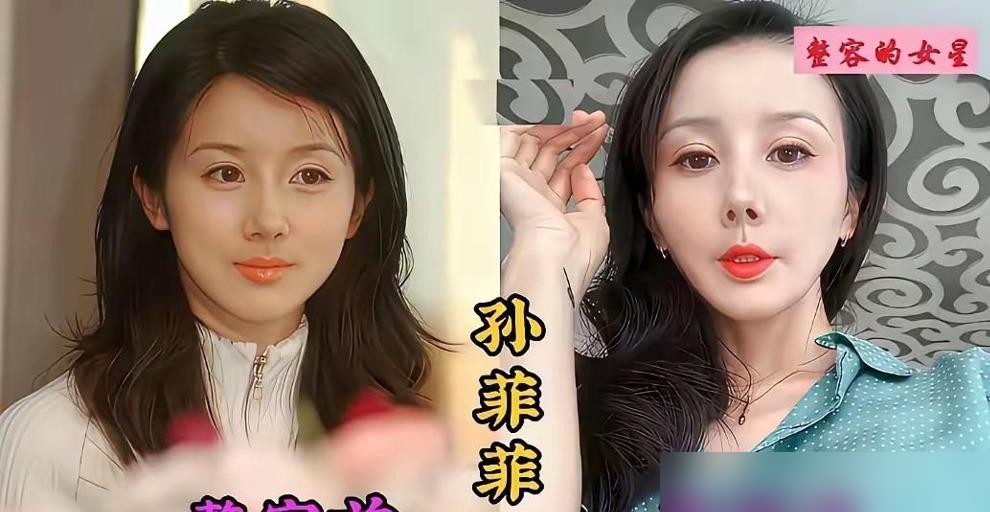 张檬把自己的脸整废了，于正直接跟她说，太吓人。
《美人心计》里她多灵啊，就一个镜头，观众记了十几年。后来演王语嫣，被网友骂丑，前男友还嫌她长相，她真去动了刀。鼻子垫了，脸填了，回来连于正都不敢用她。
2020年上综艺，她哭着说，整容把演艺生命彻底葬送了，假体已经摘了。
但市场早变了。现在剧组要