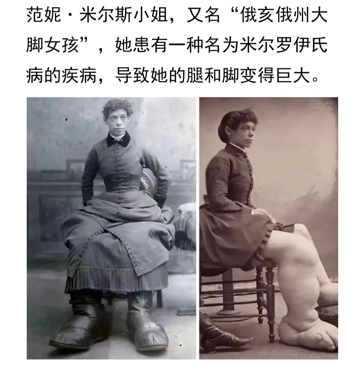 维多利亚时代的“反差萌”：上半身优雅淑女，下半身自带“体重秤暴击”