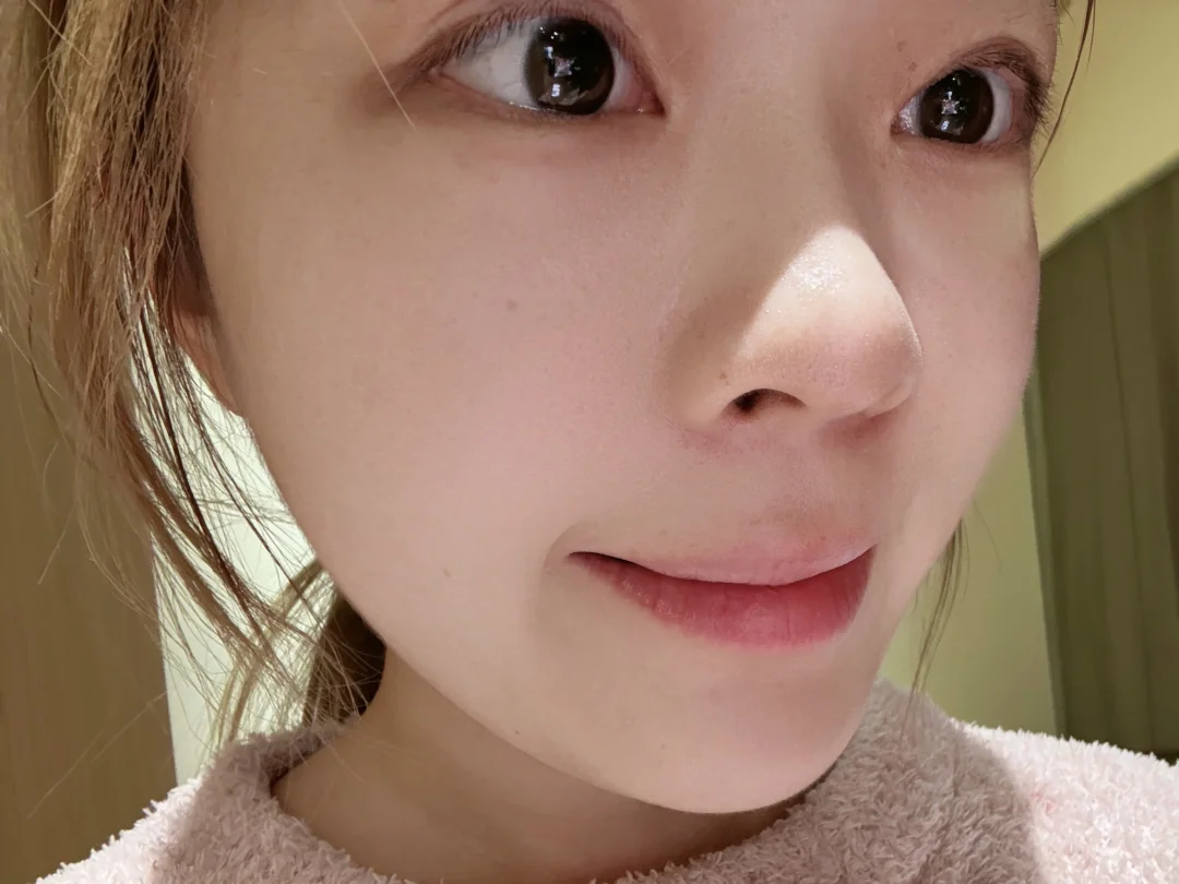 强推一个韩国的唇周漂白神剂