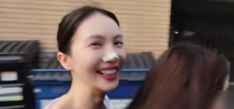 金晨鼻子上贴的那玩意儿，都以为是拍戏磕破了。
镜头拉近，是俏鼻帖。睡觉贴，上妆贴，就为了让鼻梁看着更挺。
明星连鼻孔形状都得管，比咱卷多了。
想想她8月还在长春电影节跳《钢火存帧》，9月生日前刚发律师函辟谣出国生子。
一面是生图艳压，一面是黑稿缠身。36岁，脸上贴的是帖，背后扛的是局。
能