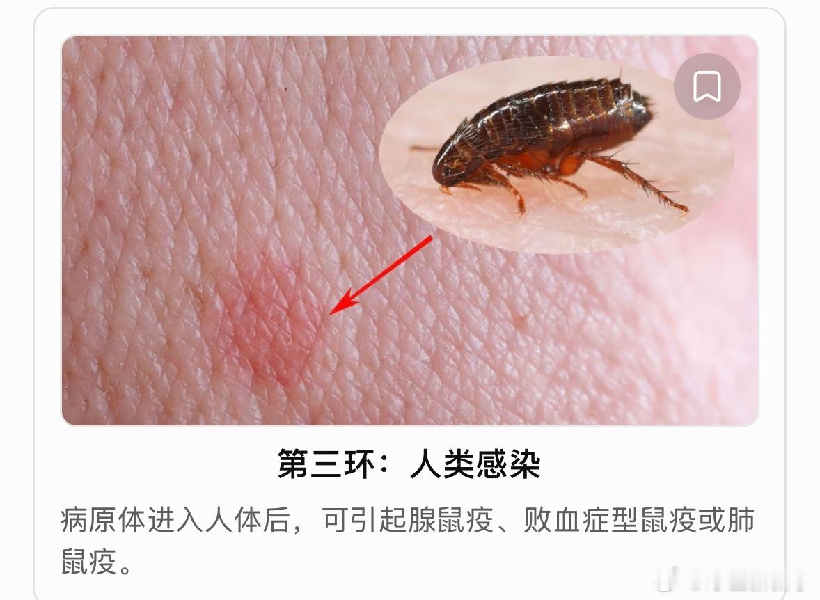 提到鼠疫，很多人会想到历史上造成大量人员死亡的黑死病。那么，鼠疫究竟是如何传播的？是不是有老鼠的地方就有危险？
#内蒙古呼伦贝尔发布鼠疫风险提示##健闻登顶计划#
鼠疫是由鼠疫耶尔森菌引起的一种急性传染病，其传播链条主要涉及**宿主动物、媒介跳蚤和人类。

首先，鼠疫菌可以在自然界的某些啮 ​