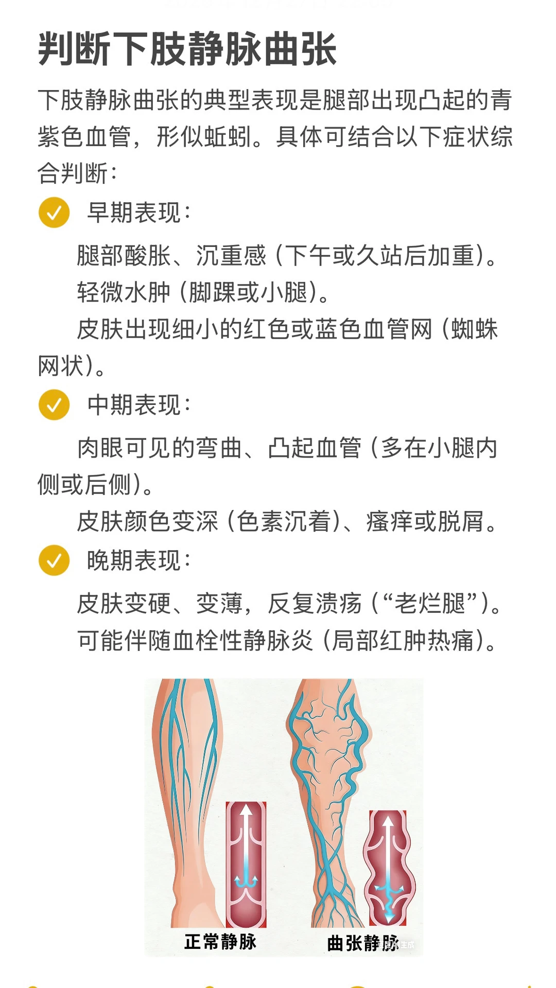 久坐久站党一定要注意预防下肢静脉曲张❗